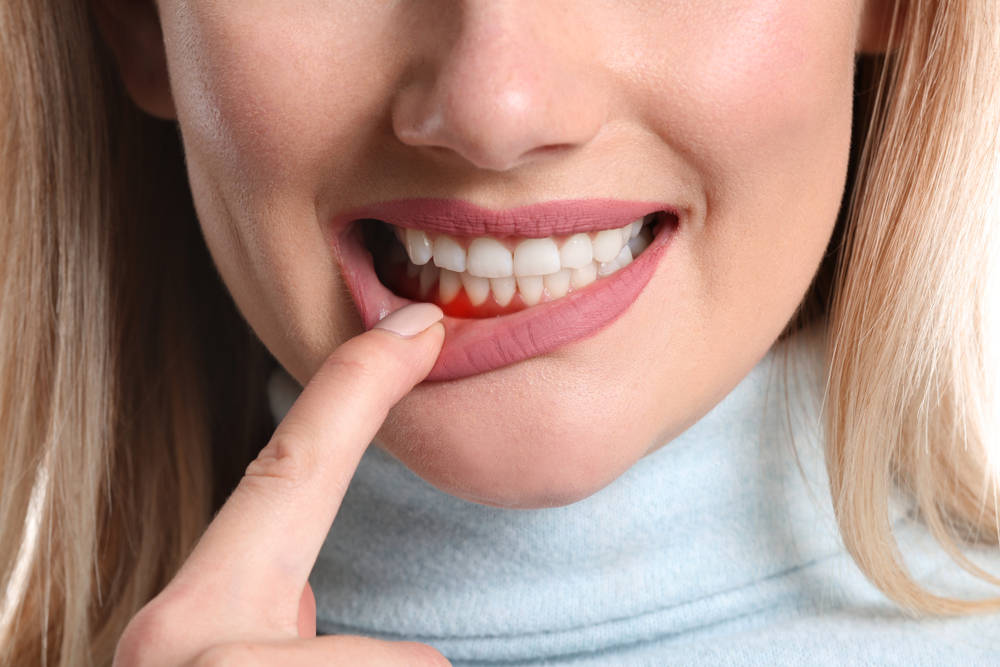 Woman,With,Gum,Inflammation,,Closeup